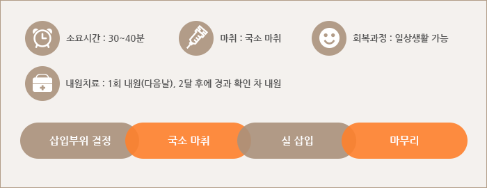 시술 과정